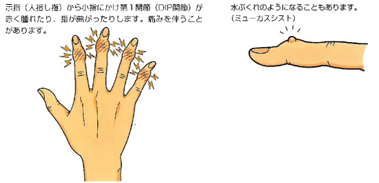 原因不明の症状だとしても!!!