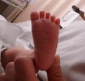 未熟児病棟 NICU