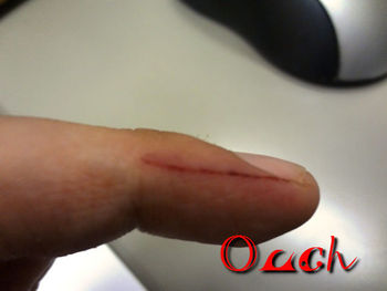 Ouch!サクッといっちゃた!