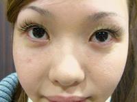 アイラッシュ